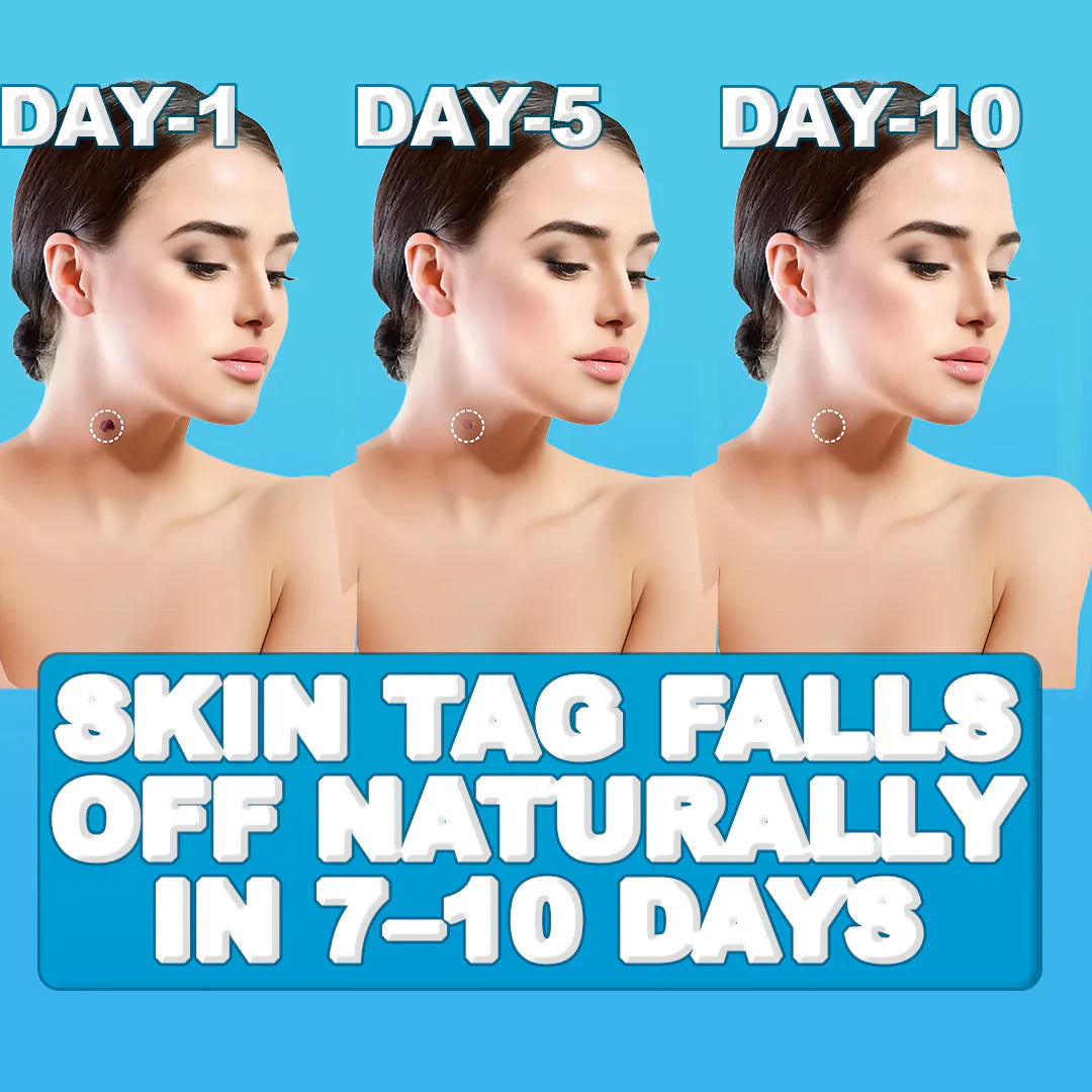 Painless Skin Tag Remover