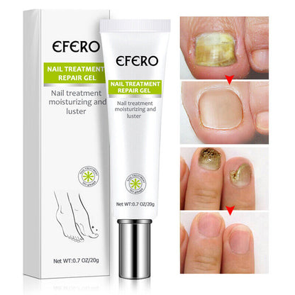 Nail Repair Treatment Gel