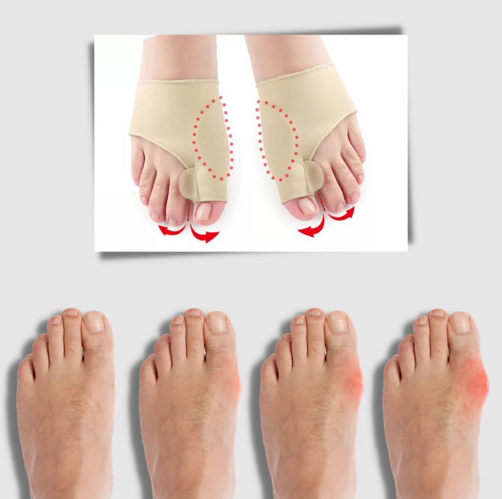 Gel bunion corrector