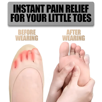 Silicone Anti-Friction Toe Protectors