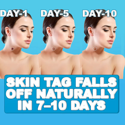 Painless Skin Tag Remover
