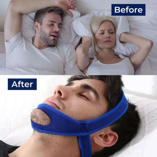 Full Head Chin Strap for Snoring Relief | Sleep Apnea Support - Comfortable - Night Use