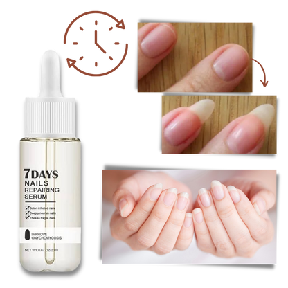 7 Days Nail Repair Essence