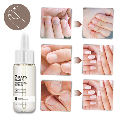 7 Days Nail Repair Essence