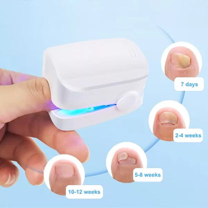 Nail Fungus Cleaning Laser Device