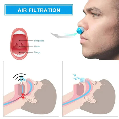 Micro CPAP Sleep Apnea Machine For Travel & Anti Snoring – CPAP Alternative