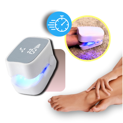 Painless laser treatment for nail fungus