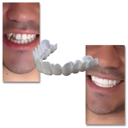 Dental coverage for a perfect smile - comfortable aligners