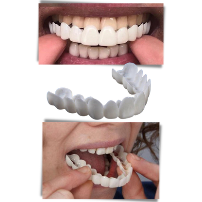 Dental coverage for a perfect smile - comfortable aligners
