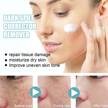 Anti-Dark Spot Skin Care Lightens Pigmentation Spots
