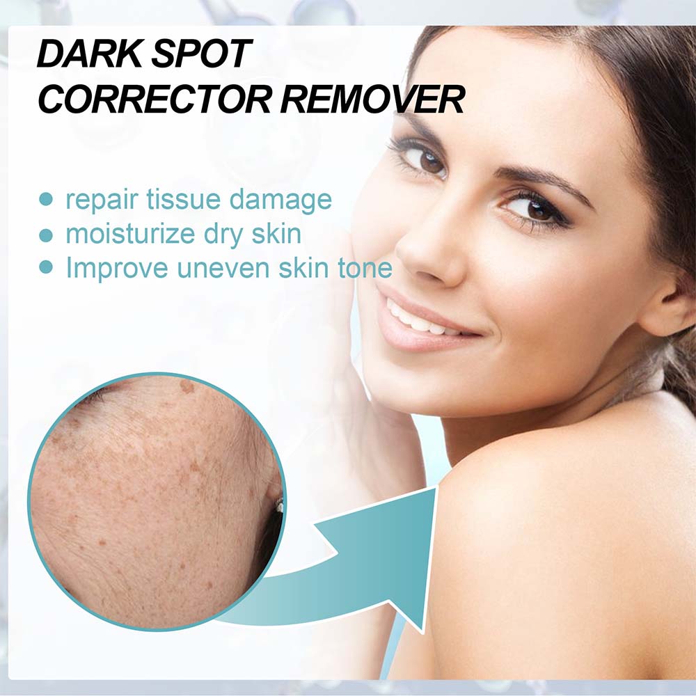 Anti-Dark Spot Skin Care Lightens Pigmentation Spots