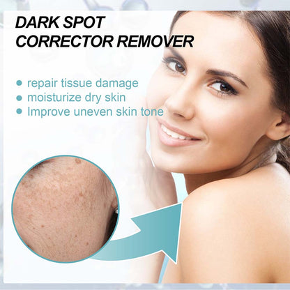 Anti-Dark Spot Skin Care Lightens Pigmentation Spots