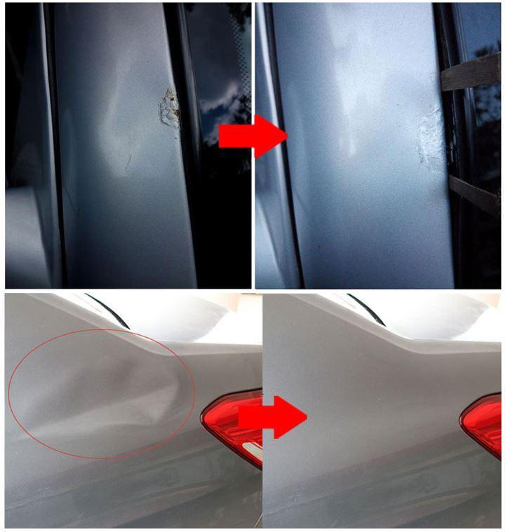 Professional Dent Removal Kit