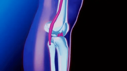 Knee Support with Adjustable Compression | for Pain Relief - Injury Recovery - Arthritis and Sports Stability