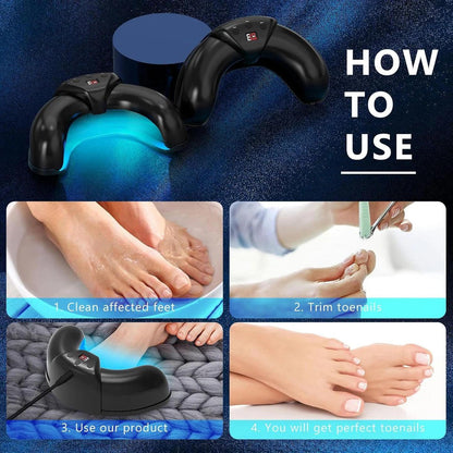 Nail Fungus Laser
