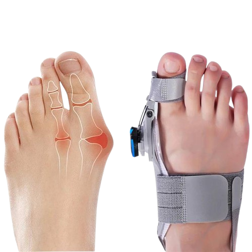 Natural Bunions Corrector Toe Spacer